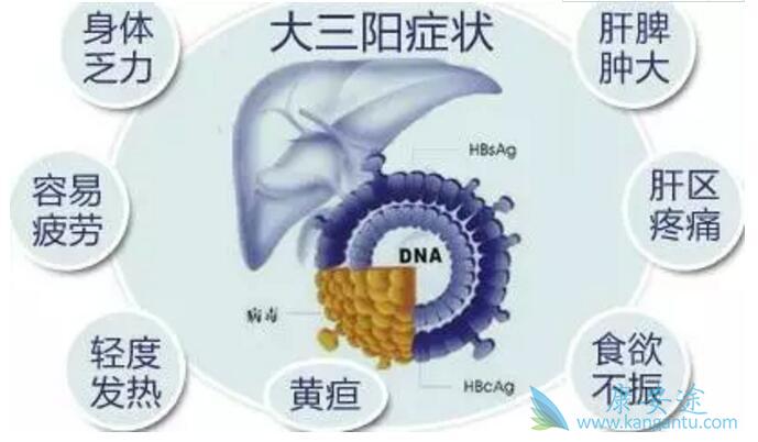 乙肝大三阳 乙肝大三阳