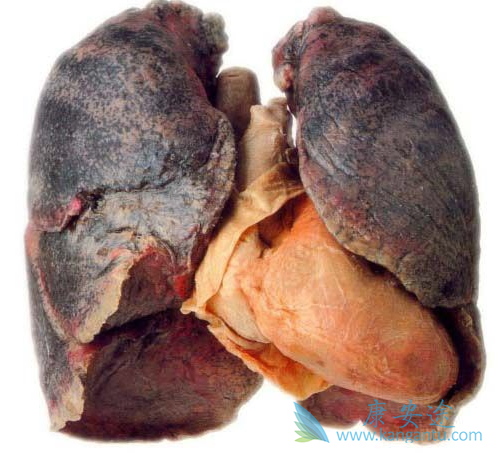 吉非替尼 吉非替尼