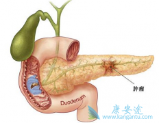 ���޿�/������������R0�г������ٰ�������Ч��