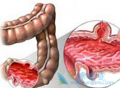 ���ᵥ��(Vectibix)�ﵽ�˸���ת���Խ�ֱ���������������ڵ�Ŀ��