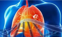 ����Сϸ���ΰ�������Щ֢״����