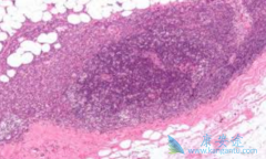 ��������(IBRANCE)�ǵ�һ�����Ƴ����ٰ������ڷ���������ҩ��ҩ��