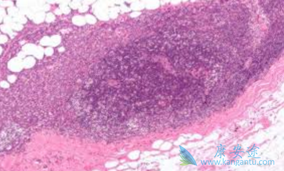 帕博西尼 帕博西尼