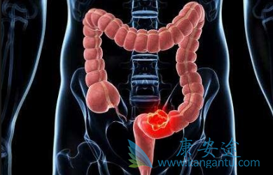 瑞戈非尼 瑞戈非尼