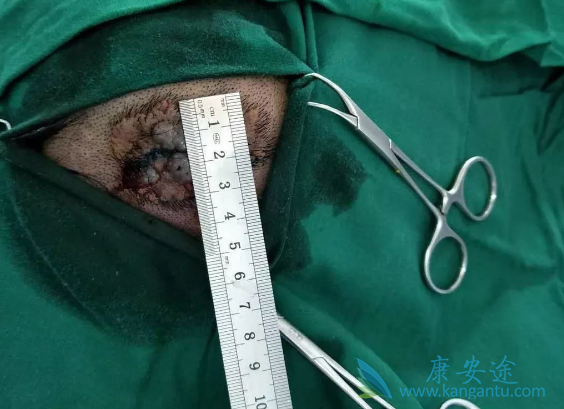 ����ϸ����