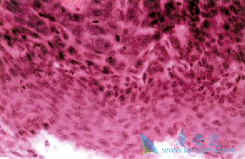 ����ϸ����