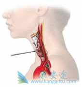 ��״�����������𣿲����ƻ��ݱ�ɼ�״�ٰ���