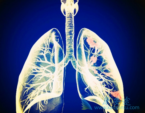 奥希替尼 奥希替尼