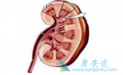 ��������(SUNITINIB)��ҩ����ת�����������������г�+��������