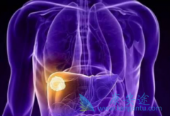 �ΰ������ƹ����м���������øΰ��������ƻ���