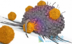 �����尩������֢״����ʲô�����˱����尩��ô���ƣ�