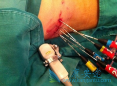 �ճ��������Ԥ���ΰ����ΰ����Ʒ�������Щ��