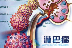 ���ÿ�������(CRIZOTINIB)��ȫ�����ͣҩ�ָ�������ô����