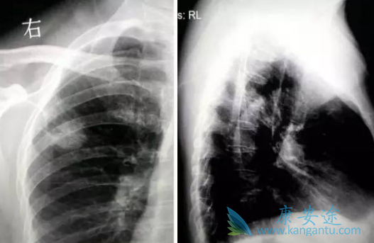 印度易瑞沙 印度易瑞沙