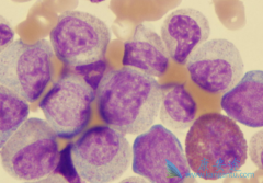 ��ϣ��(Tasigna)�й������շ���ǰ���֪ҽ������ԭ���