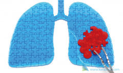 ������������(afatinib)�ļ����Ǽ��ٲ�����Ӧ��һ����Ч��ʩ