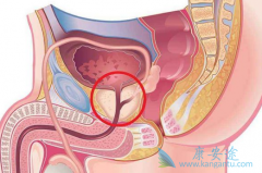 ǰ���ٰ����߷��ð�������(XBIRA)�������ز�����Ӧ�ĸ����Ƕ���