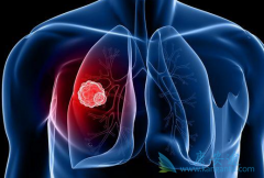 �ΰ���Ĥת�ƺ������ҩ�����޿���