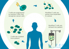 �Ѱ�ЧӦ��CAR-Tϸ�����Ƶ�ȱ��֮һ ��ν��CAR-T�Ʒ��Ѱ����⣿