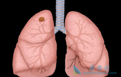 ������/����������­���޽�չ����Ϳ͹ۻ����ʷ�������ֳ���Խ��