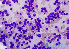 ����/�������׶Ծ��и�Σ���صĶ෢�Թ���������Ҳ������