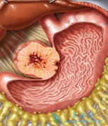 �о���������/���������ܸ���KTI����ȥ��������ϸ��