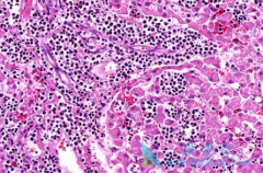 ���ǳ�˵��Ѫ���ǰ�Ѫ���𣿰�Ѫ����Ⱦ��