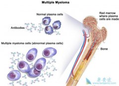 �෢�Թ�����֢״������ԭ��̽��