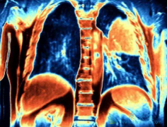 �ΰ�ҩ���ϣ����(AZD9291)���µĲ�����Ӧ������