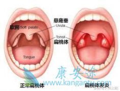 �����尩��֢״����Щ�������ЧԤ����