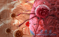 ������HBV��ظΰ�����ʹ�ö༪��(SORAFENIB)���Ƶ��������