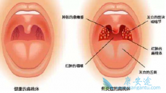 �����尩�ص�����Щ�������ٴ��ź���ʲô��