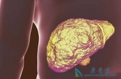 ��������(SORAFENAT)����HCV+�ĸΰ�����������������