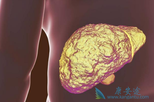 索拉菲尼 索拉菲尼