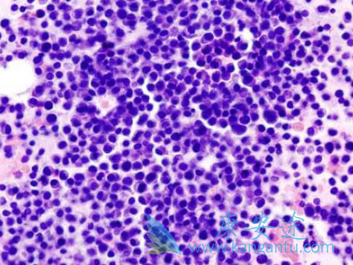 雷利米得 雷利米得