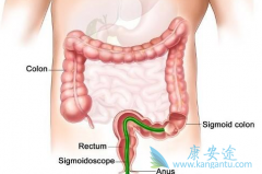 �ҹ��ж��ٽ�ֱ�������ߣ���ֱ������Σ������Щ��