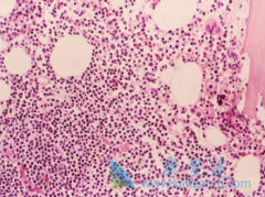 ��ϣ��(Tasigna)��������Ѫ���л�������