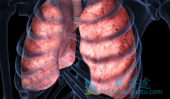 ɫ������(Ceritinib)������ROS1�������ŷΰ����ߵ�������