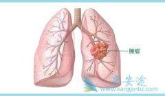 �ΰ�����������ܹ���Ч�ر���ΰ�ת��