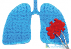 ��������(Iressa)ֻ���������Ƽ�������ʧ�ܵķΰ�������