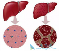 �༪��(SORAFENIB)��ʹ���ߵ�����ȫ����ʧ�������