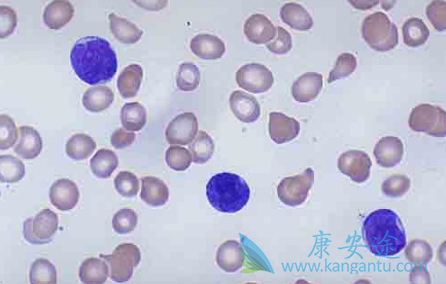 伊马替尼 伊马替尼