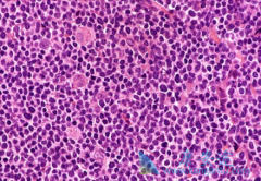 ��³����(IBRUTINIB)�Ĳ����¼���ʱ���ӳ�������