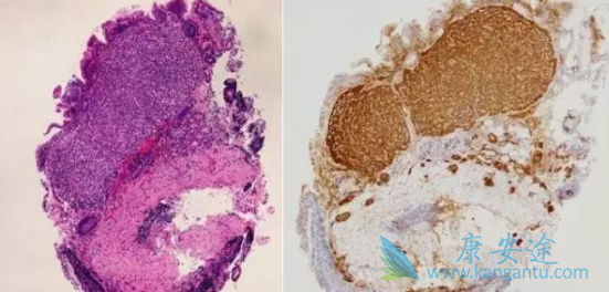 帕唑帕尼 帕唑帕尼