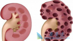 ��������/���������Ƽ�����ʼ����Ϊ5mg