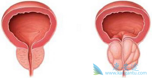 阿比特龙 阿比特龙