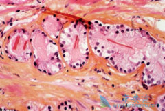 Ϊʲô���߷��ð�������(ABIRATERONE)ǰ��Ҫ���ι���