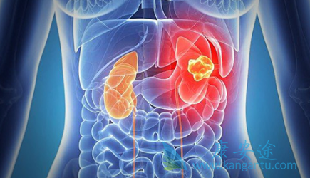 舒尼替尼 舒尼替尼