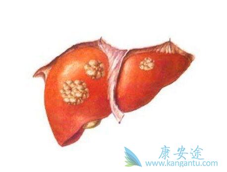 乙肝携带者 乙肝携带者