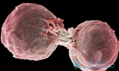 ��������(Bevacizumab)�������ƶ�ͯ��������